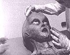 autopsy4a.jpg